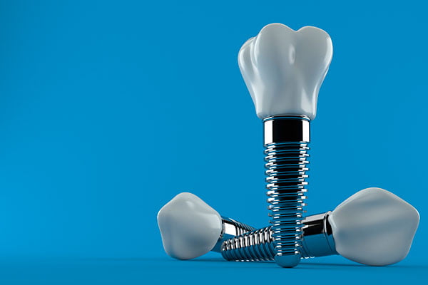 dental implant treatment north york bayview clinic advanced